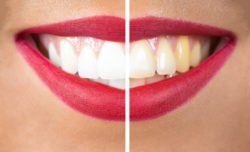 cosmetic dentistry westborough